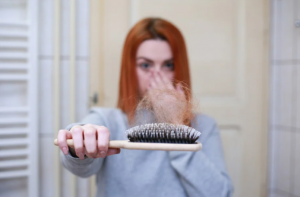 Hair loss