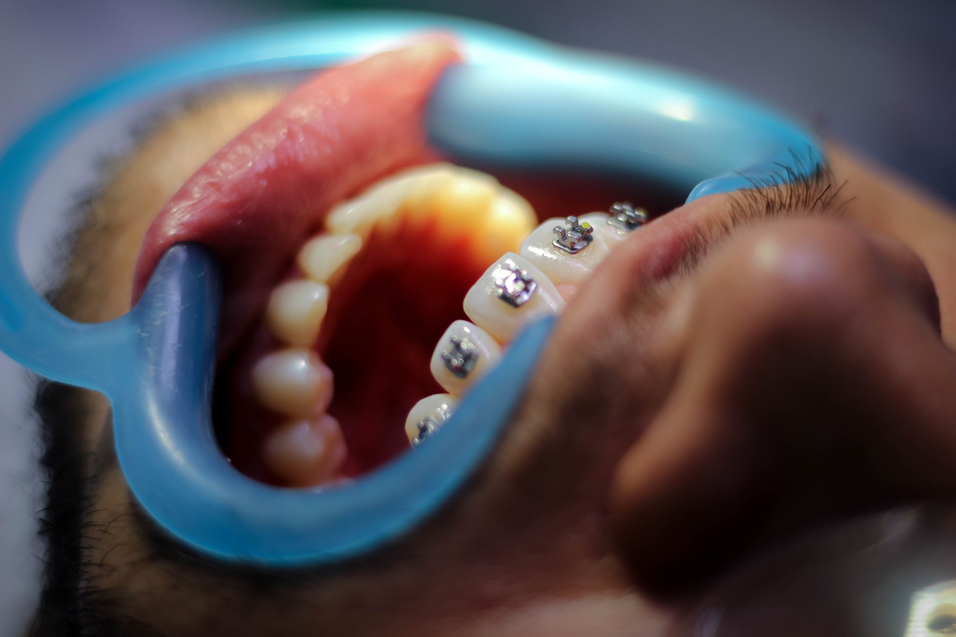Teeth